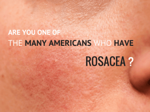Could you have rosacea