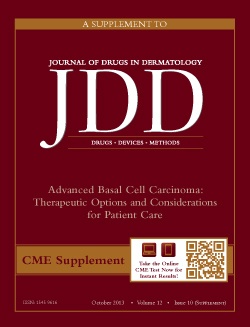 Purpura Treatment in November 2013 issue of JDD