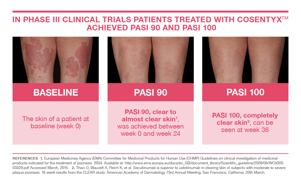 Before and after photos of psoriasis treatment Cosentyx