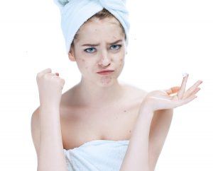 Young woman frustrated with acne