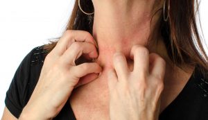 Photo of women scratching her neck