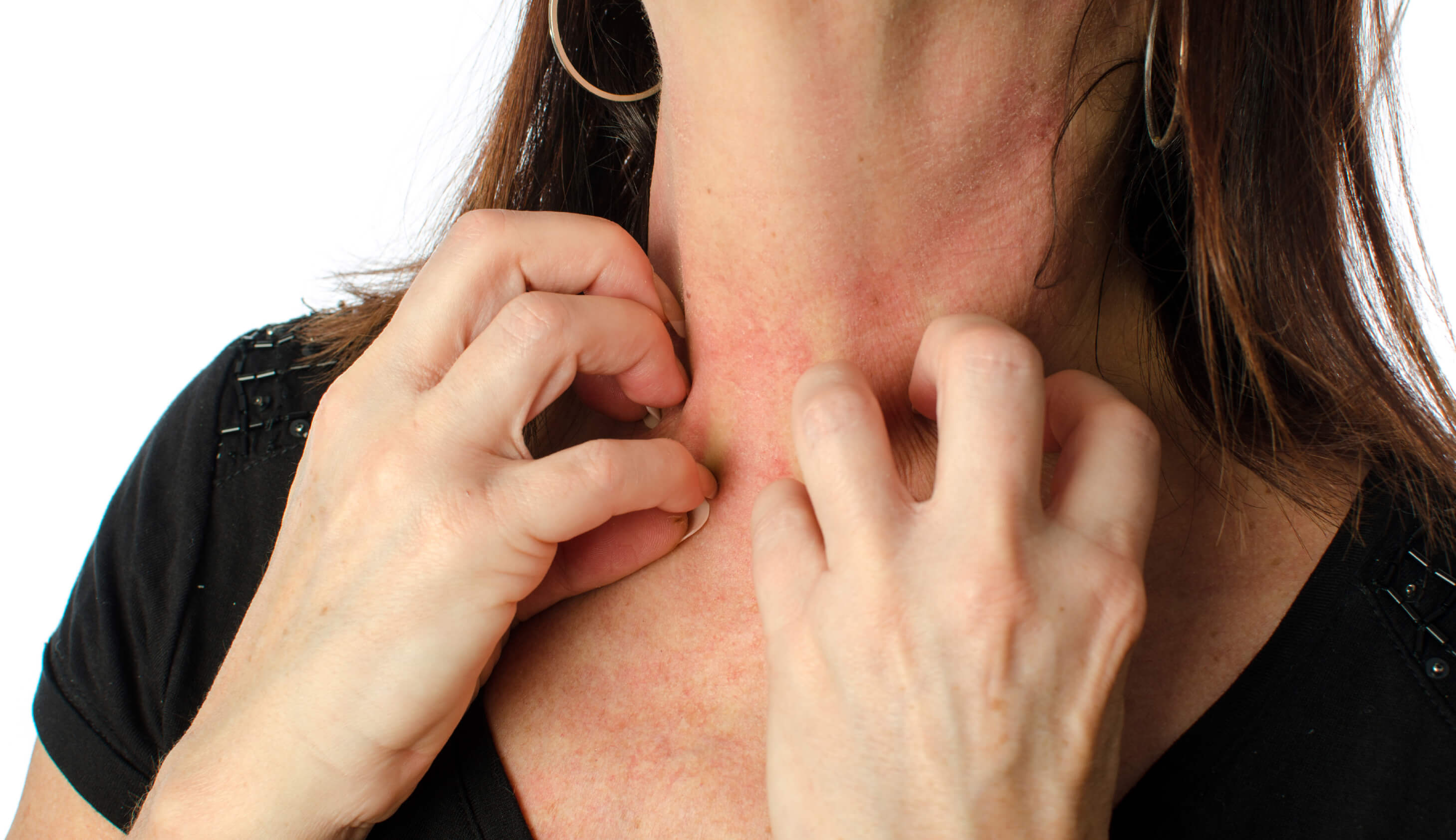 Can Nail Scratching Transmit HIV?