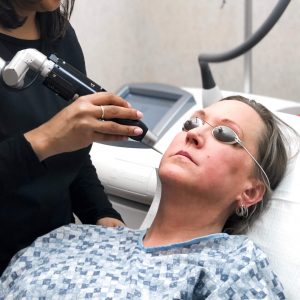 Woman getting a PicoToning laser treatment to improve her facial skin color and texture