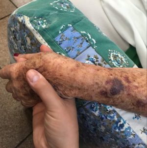 Krysten Cefalo holding a patient hand