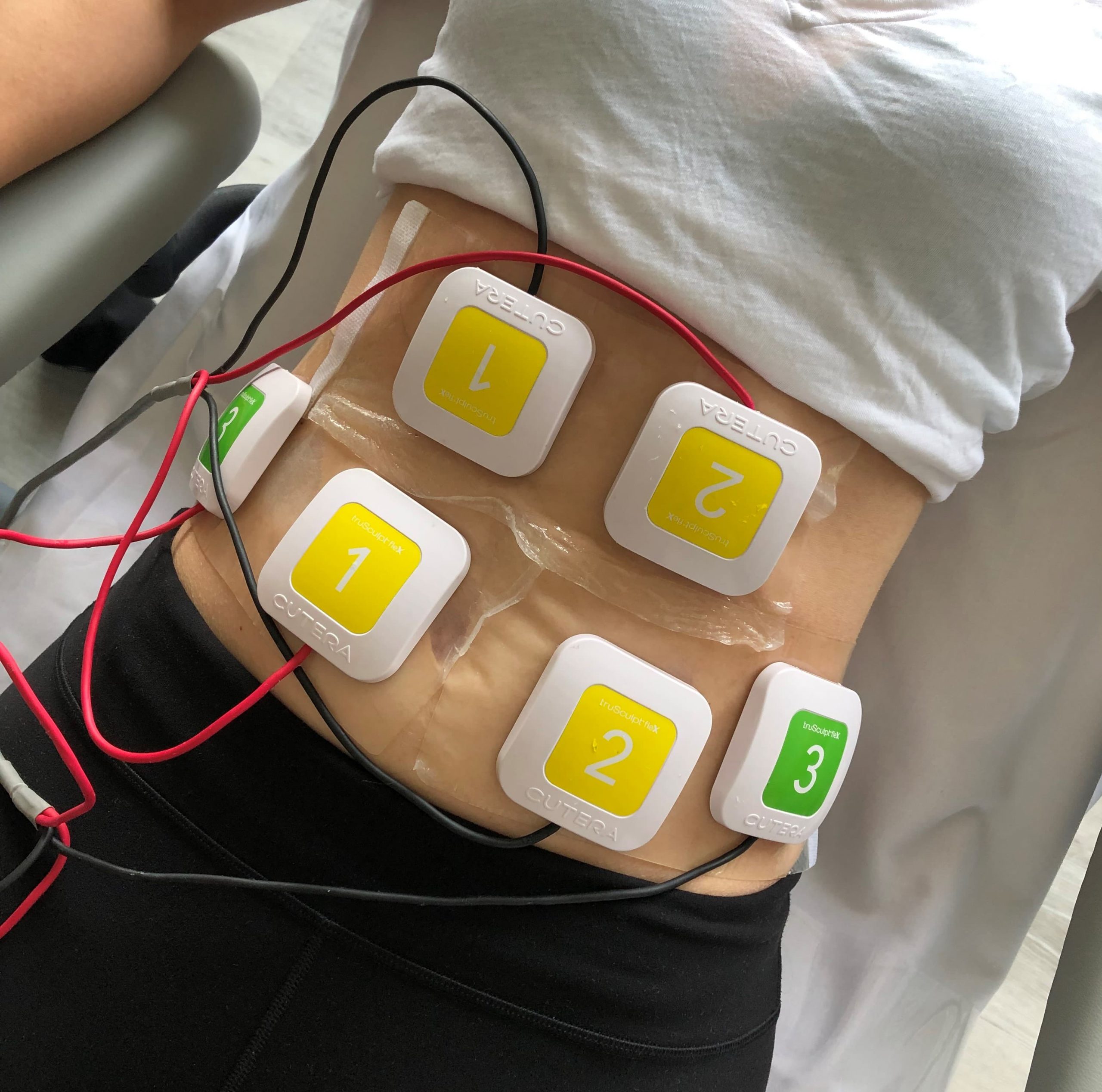 Electrical Muscle Stimulation in Texas