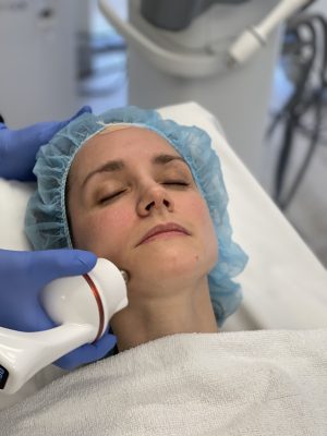 Dr. Morting havinf a RF microneedling treatment