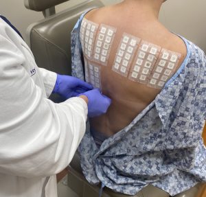 Katie Brodt applying patch tests to a patient 