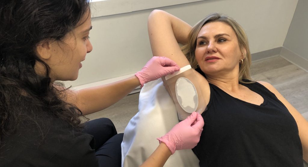 Brella sweat control patch for hyperhidrosis