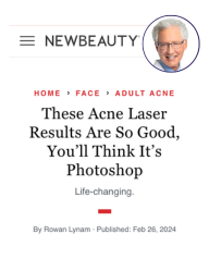 NewBeauty article quoting Dr. Dover on AviClear 