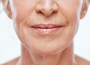 Woman with smoker's line above her lips 