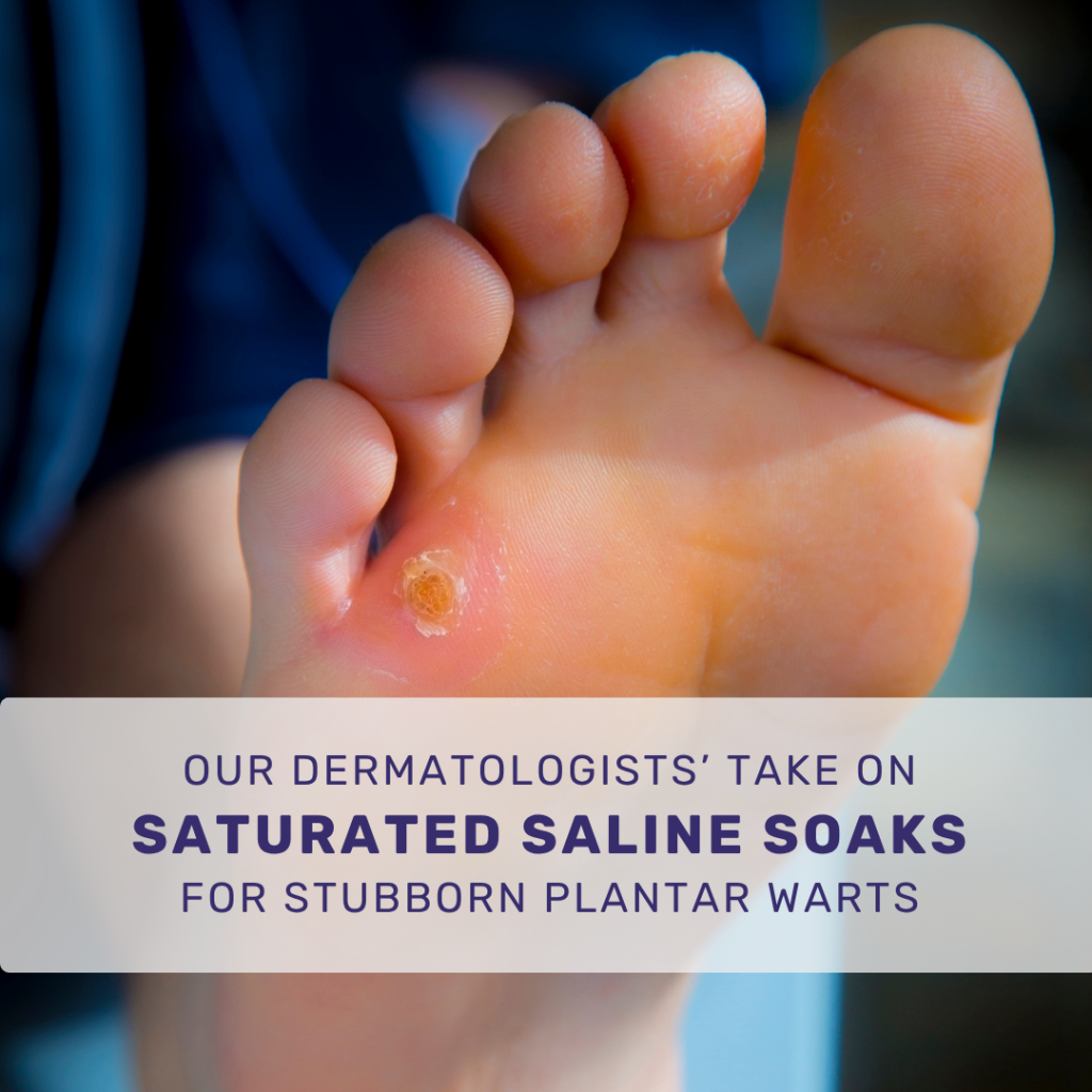 Plantar wart on a kid's feet