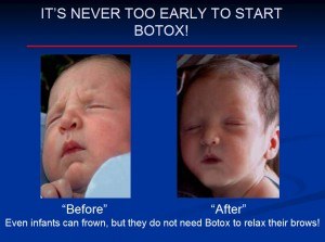 It's never too early to start Botox